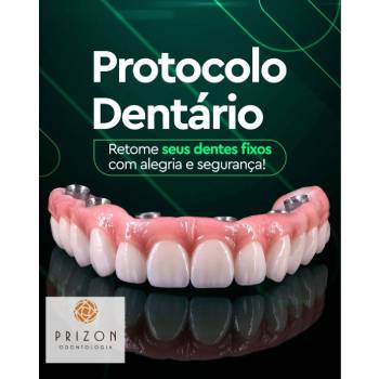 Dentadura Parafusada em Cocaia - Guarulhos