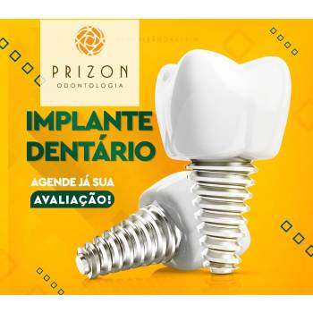 Implante Dentário Valor em Cocaia - Guarulhos