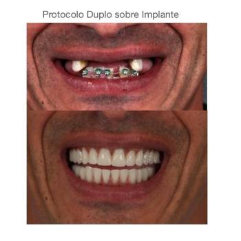 Protocolo Dentário no Bom Clima - Guarulhos